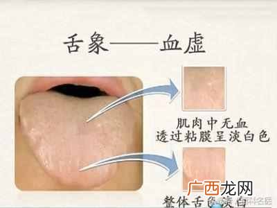 湿气重怎么办，湿气重怎么调理！