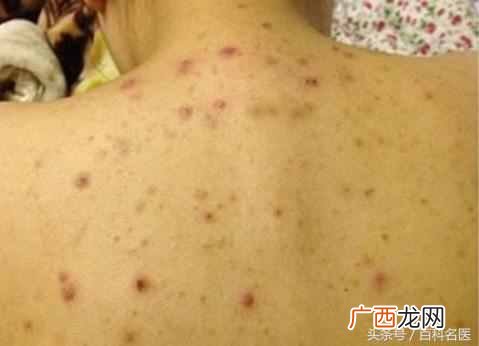 湿气重怎么办，湿气重怎么调理！