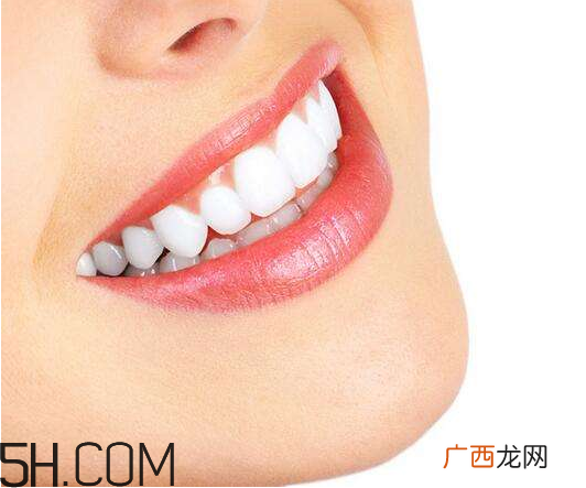 烤瓷牙为什么会有缝隙？烤瓷牙的注意事项有哪些？