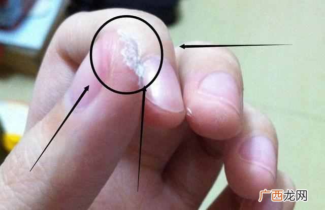 502胶水把手黏住了怎么办，教你几招去胶！
