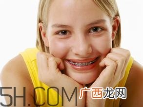 补牙需要带牙套吗？补牙后要装牙套多少钱？
