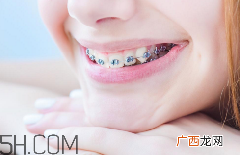 戴牙套怎么使用电动牙刷？佩戴牙套的注意事项