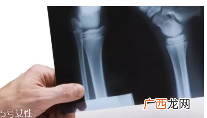 冬天老人容易犯哪些病?低温易诱发5种病