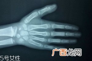 哪些人需要测骨龄？长太快警惕骨龄提前