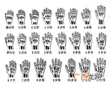 哪些人需要测骨龄？长太快警惕骨龄提前