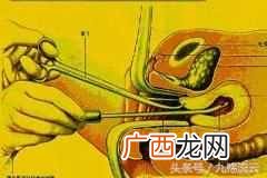 人工流产的最佳时间，人流的危害有哪些！