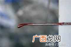 人工流产的最佳时间，人流的危害有哪些！