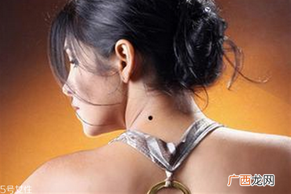 脖子后面有痣代表什么？10大身体缺陷是好事