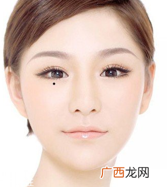 脖子后面有痣代表什么？10大身体缺陷是好事