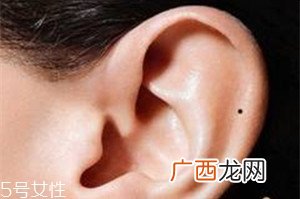 脸上哪些痣不能去掉？这些痣不能随便祛掉