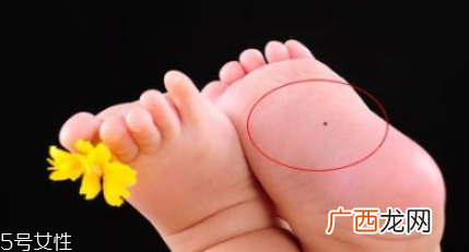痣什么情况下会转变为瘤?点痣不可取