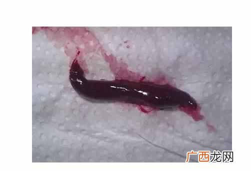 大姨妈是什么意思，需要注意哪些方面！