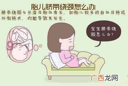 胎儿脐带绕颈一周怎么办，孕妈需要知道的几个