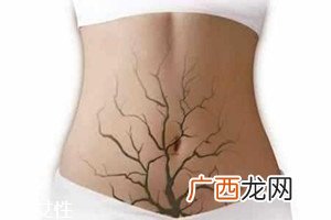体内毒素超标有何表现？五大症状须注意