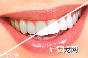 牙齿发黄是天生的吗？只是你刷牙偷懒了