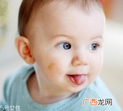 胎记怎么去除？胎记有遗传的可能