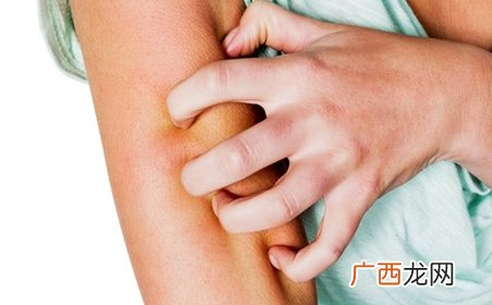 冬天皮肤痒怎么回事4种原因需警惕