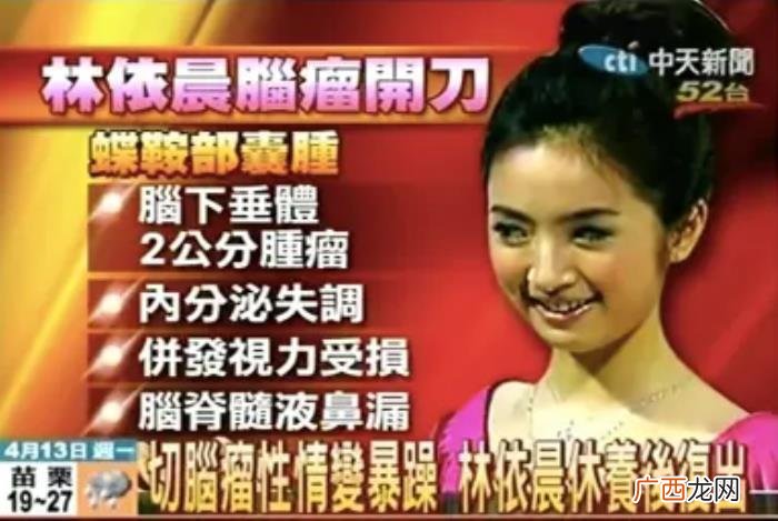 林依晨主演过的电视剧，美少女林依晨的10年上位史