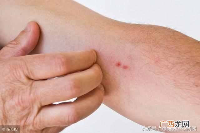身上痒一抓就起疙瘩是怎么回事，如何治疗！