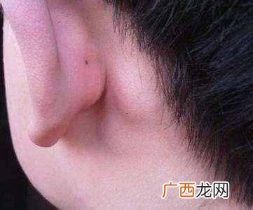耳垂里有硬块是怎么回事，千万不能大意的症状