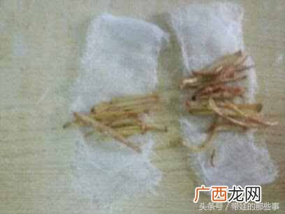 流鼻涕打喷嚏吃什么药，宝妈推荐超级实用！