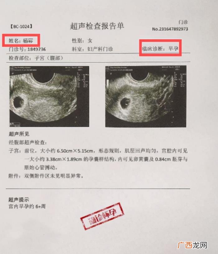 杨幂怀孕肚子疼，杨幂被传再婚且已怀孕