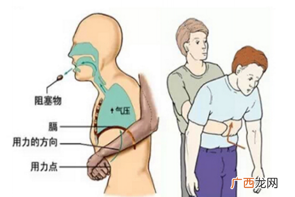 宝宝把口香糖吞下去了怎么办宝宝噎着急救方法