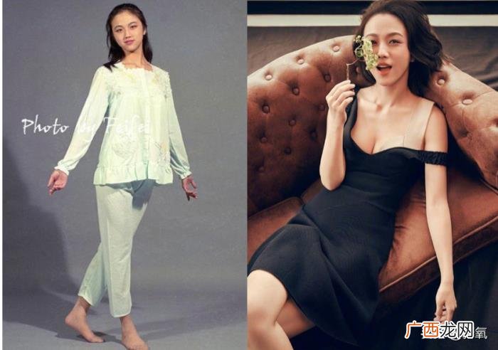 金晨为什么，为什么金晨的脸整形痕迹那么明显
