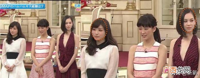 金晨为什么，为什么金晨的脸整形痕迹那么明显