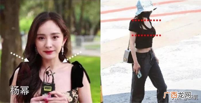 金晨为什么，为什么金晨的脸整形痕迹那么明显