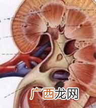 尿结石吃什么好，有哪些禁忌是不能吃的！