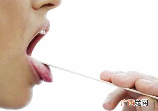 治疗咽炎的偏方有哪些，咽炎有哪些症状！