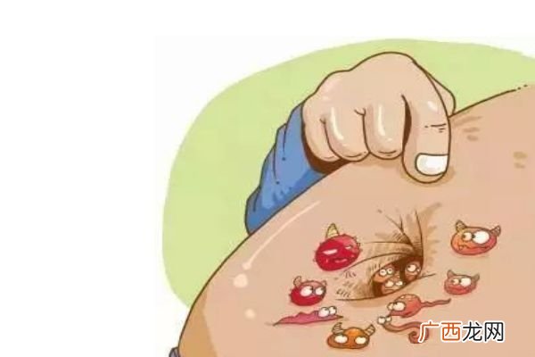 肚脐为什么不能用手抠那该如何清洗肚脐