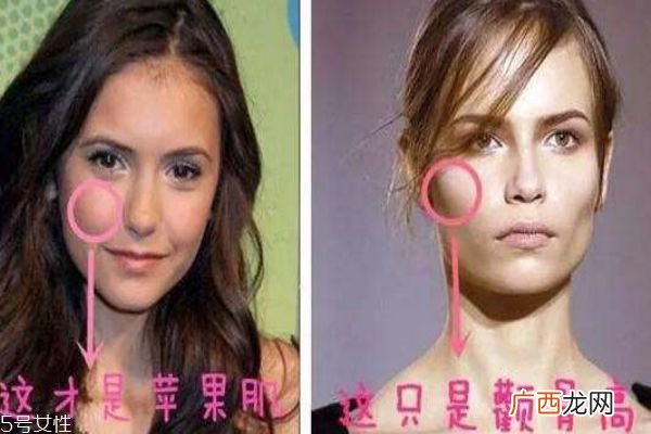 苹果肌和颧骨高区别别再傻傻分不清楚
