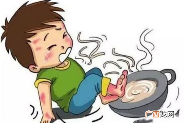烫伤涂牙膏管用吗千万不要涂牙膏啦