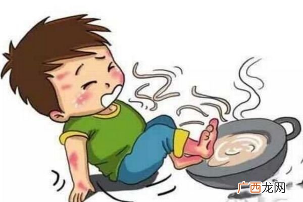 烫伤后的水泡能挑破吗怎样挑破水泡才不容易引起感染
