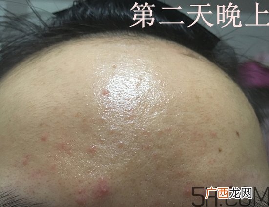 nyr金盏花膏怎么样_nyr金盏花膏好用吗