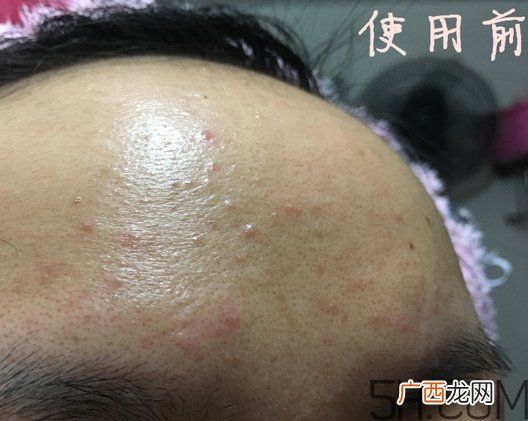 nyr金盏花膏怎么样_nyr金盏花膏好用吗