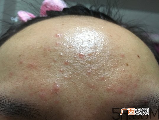 nyr金盏花膏怎么样_nyr金盏花膏好用吗