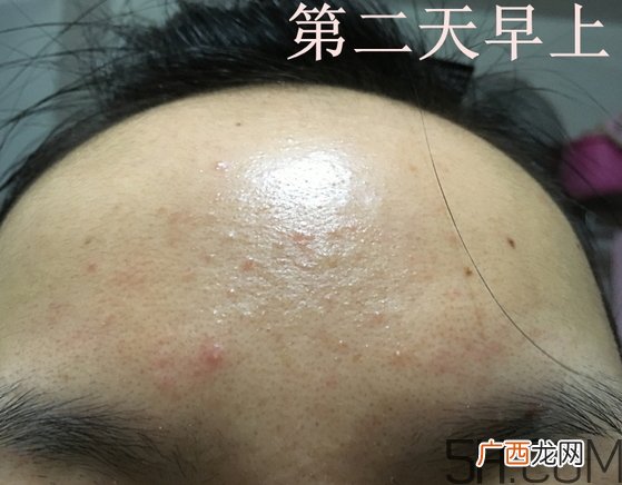 nyr金盏花膏怎么样_nyr金盏花膏好用吗