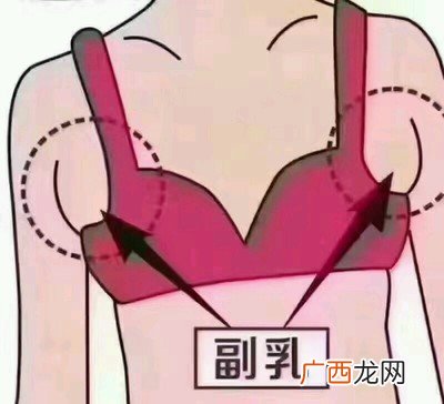 什么是副乳怎么判断自己有没有副乳