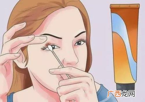 麦粒肿可以戴隐形眼镜吗麦粒肿能传染吗