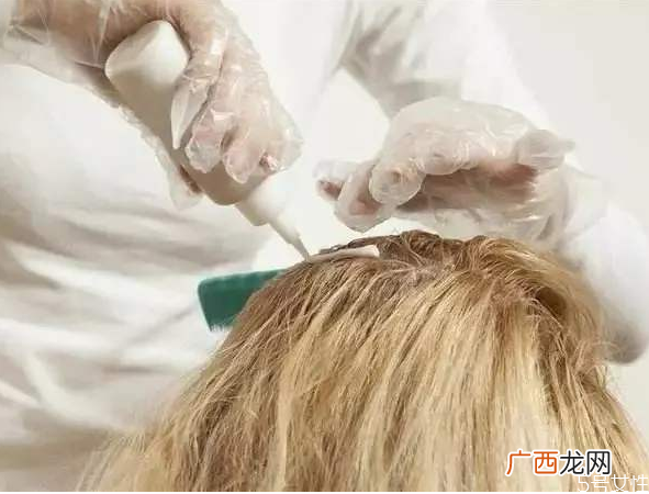 染发剂过敏症状染发剂过敏怎么治疗