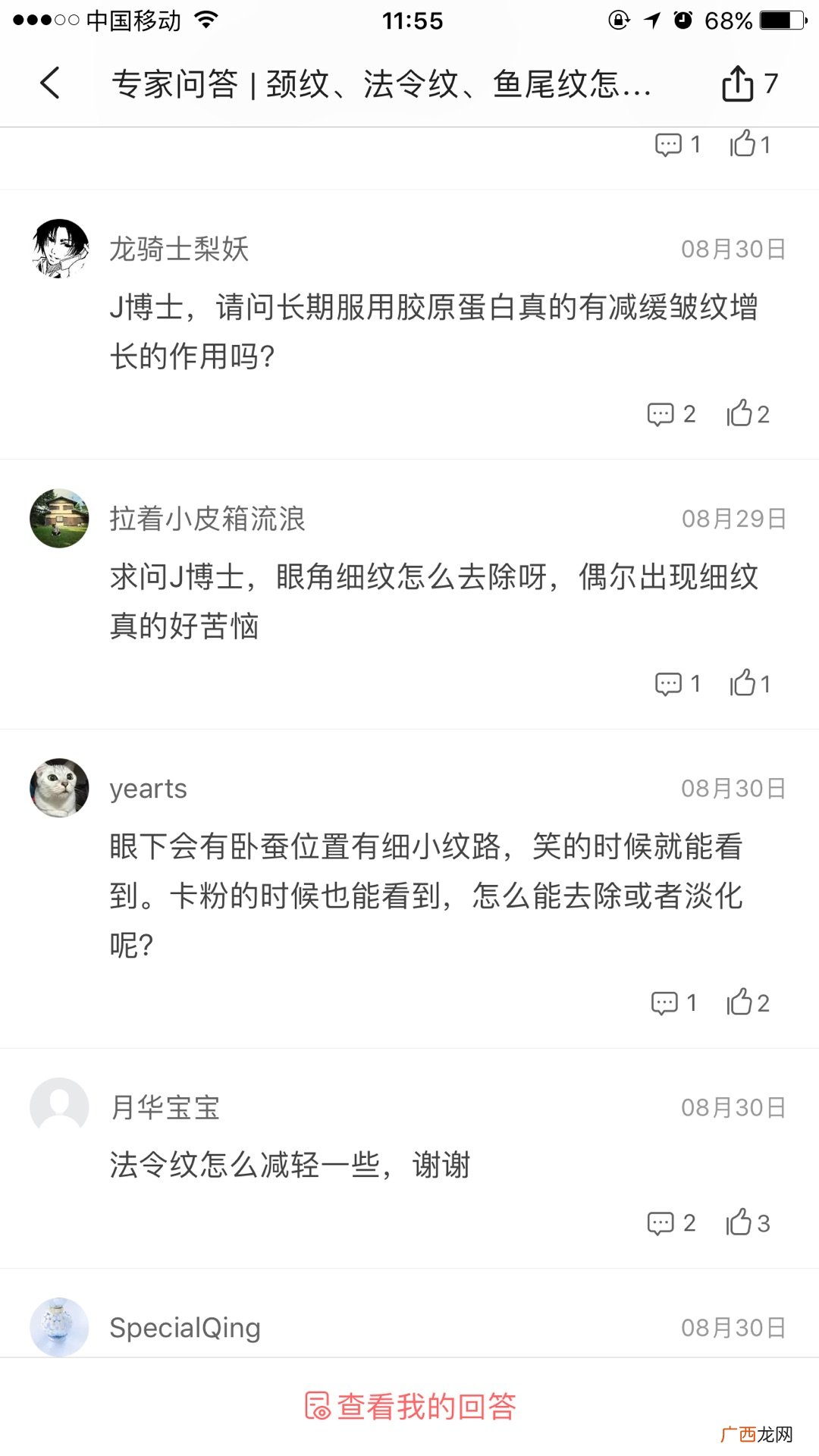 天生的鱼尾纹怎么去除或淡化