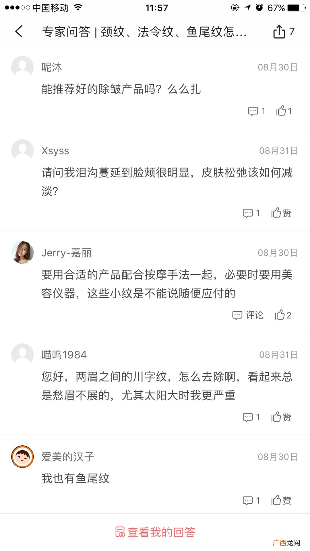 天生的鱼尾纹怎么去除或淡化