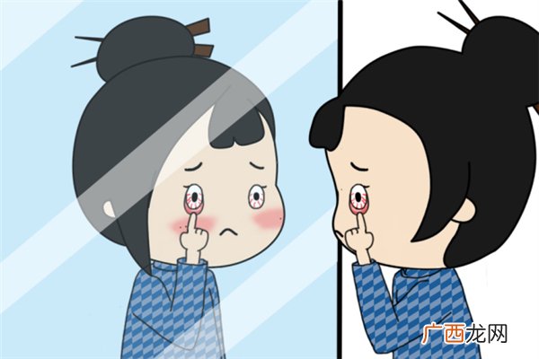 眼睛有血丝怎么回事眼睛有血丝是结膜炎吗