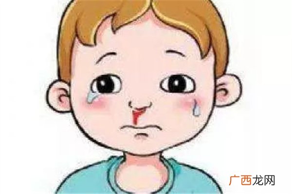 流鼻血有血块是什么原因引起的流鼻血会导致贫血吗