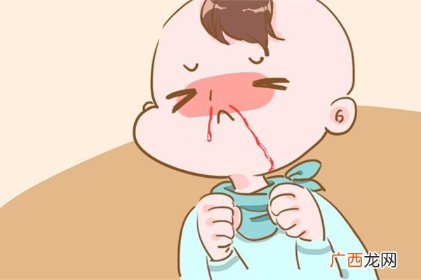 流鼻血要抬头还是低头流鼻血仰头的危险性