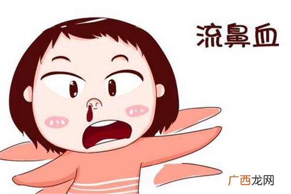 流鼻血止不住怎么办流鼻血是什么病的症状