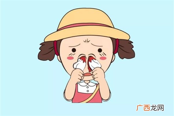 流鼻血是什么原因引起的呢流鼻血的正确止血办法